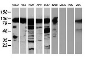 ERIC-1 / TACC3 Antibody - Western blot of extracts (35 ug) from 9 different cell lines by using anti-TACC3 monoclonal antibody (HepG2: human; HeLa: human; SVT2: mouse; A549: human; COS7: monkey; Jurkat: human; MDCK: canine; PC12: rat; MCF7: human).