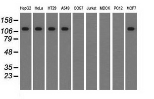 ERIC-1 / TACC3 Antibody - Western blot analysis of extracts (35ug) from 9 different cell lines by using anti-TACC3 monoclonal antibody.