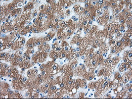 ERIC-1 / TACC3 Antibody - Immunohistochemical staining of paraffin-embedded Human liver tissue using anti-TACC3 mouse monoclonal antibody. (Dilution 1:50).
