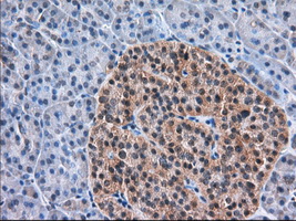 ERIC-1 / TACC3 Antibody - Immunohistochemical staining of paraffin-embedded Human pancreas tissue using anti-TACC3 mouse monoclonal antibody. (Dilution 1:50).