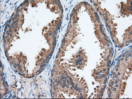 ERIC-1 / TACC3 Antibody - Immunohistochemical staining of paraffin-embedded Human prostate tissue using anti-TACC3 mouse monoclonal antibody. (Dilution 1:50).