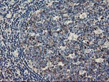 ERIC-1 / TACC3 Antibody - IHC of paraffin-embedded Human lymph node tissue using anti-TACC3 mouse monoclonal antibody. (Heat-induced epitope retrieval by 10mM citric buffer, pH6.0, 100C for 10min).