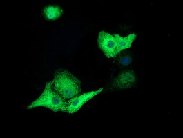 ERIC-1 / TACC3 Antibody - Anti-TACC3 mouse monoclonal antibody immunofluorescent staining of COS7 cells transiently transfected by pCMV6-ENTRY TACC3.