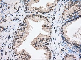 ERIC-1 / TACC3 Antibody - IHC of paraffin-embedded Human prostate tissue using anti-TACC3 mouse monoclonal antibody. (Dilution 1:50).