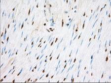 ERIC-1 / TACC3 Antibody - IHC of paraffin-embedded Human colon tissue using anti-TACC3 mouse monoclonal antibody. (Dilution 1:50).