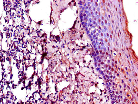ERIC-1 / TACC3 Antibody - Immunohistochemistry of paraffin-embedded human tonsil tissue using TACC3 Antibody at dilution of 1:100