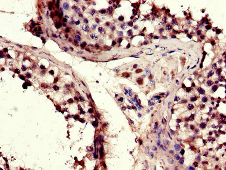 ERIC-1 / TACC3 Antibody - Immunohistochemistry of paraffin-embedded human testis tissue using TACC3 Antibody at dilution of 1:100