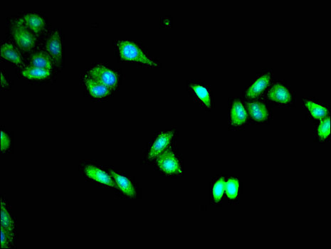ERIC-1 / TACC3 Antibody - Immunofluorescent analysis of HepG2 cells using TACC3 Antibody at a dilution of 1:100 and Alexa Fluor 488-congugated AffiniPure Goat Anti-Rabbit IgG(H+L)