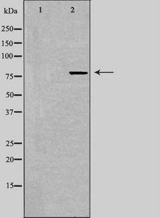 ERIC-1 / TACC3 Antibody - Western blot analysis of extracts of 293 cells using TACC3 antibody. The lane on the left is treated with the antigen-specific peptide.