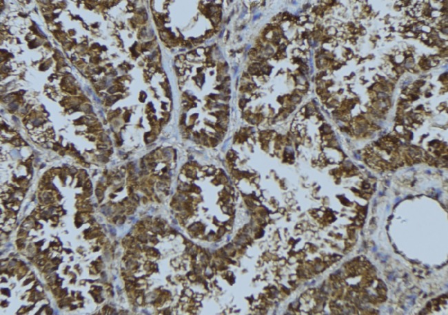 ERIC-1 / TACC3 Antibody - 1:100 staining mouse testis tissue by IHC-P. The sample was formaldehyde fixed and a heat mediated antigen retrieval step in citrate buffer was performed. The sample was then blocked and incubated with the antibody for 1.5 hours at 22°C. An HRP conjugated goat anti-rabbit antibody was used as the secondary.