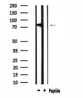 ERIC-1 / TACC3 Antibody - Western blot analysis of extracts of rat muscle using TACC3 antibody.