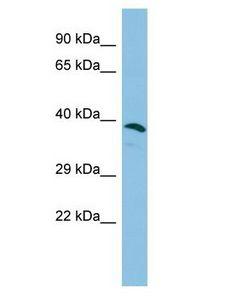 ERICH1 Antibody - ERICH1 antibody Western Blot of Fetal Liver. Antibody dilution: 1 ug/ml.  This image was taken for the unconjugated form of this product. Other forms have not been tested.