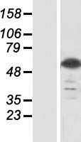 ERICH5 / C8orf47 Protein - Western validation with an anti-DDK antibody * L: Control HEK293 lysate R: Over-expression lysate
