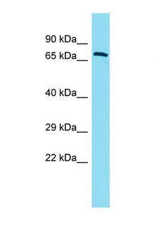 ERICH6B / FAM194B Antibody - Western blot of Human Fetal Lung. FAM194B antibody dilution 1.0 ug/ml.  This image was taken for the unconjugated form of this product. Other forms have not been tested.