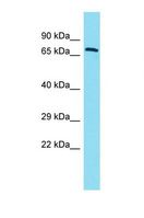ERICH6B / FAM194B Antibody - Western blot of Human Fetal Lung. FAM194B antibody dilution 1.0 ug/ml.  This image was taken for the unconjugated form of this product. Other forms have not been tested.