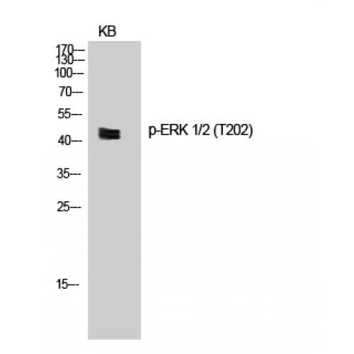 ERK1 + ERK2 Antibody - Western blot of Phospho-ERK 1/2 (T202) antibody