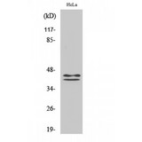 ERK1 + ERK2 Antibody - Western blot of Phospho-ERK 1/2 (Y204) antibody