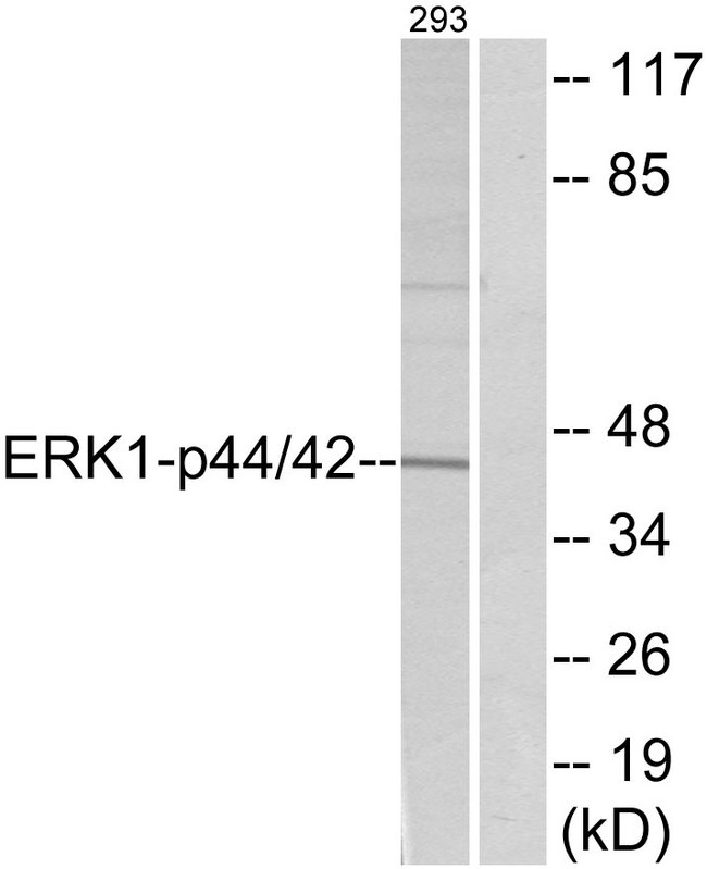 ERK1 + ERK2 Antibody - Western blot analysis of lysates from 293 cells, treated with EGF 200 ng/ml 30', using p44/42 MAP Kinase Antibody. The lane on the right is blocked with the synthesized peptide.