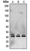 ERK1 + ERK2 Antibody - Western blot analysis of ERK1/2 expression in HeLa (A); NIH3T3 (B); PC12 (C) whole cell lysates.