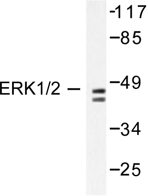 ERK1 + ERK2 Antibody - Western blot of ERK1/2 (L352) pAb in extracts from COLO205 cells.