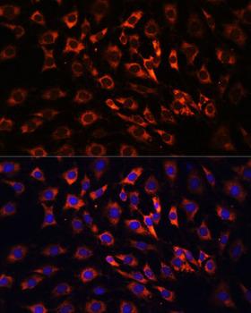 ERK1 + ERK2 Antibody - Immunofluorescence analysis of C6 cells using ERK1 / ERK2 Polyclonal Antibody at dilution of 1:100 (40x lens).Blue: DAPI for nuclear staining.