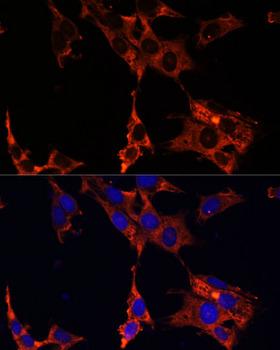 ERK1 + ERK2 Antibody - Immunofluorescence analysis of NIH/3T3 cells using ERK1 / ERK2 Polyclonal Antibody at dilution of 1:100 (40x lens).Blue: DAPI for nuclear staining.