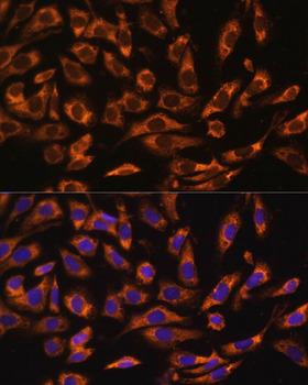 ERK1 + ERK2 Antibody - Immunofluorescence analysis of U-2OS cells using ERK1 / ERK2 Polyclonal Antibody at dilution of 1:100 (40x lens).Blue: DAPI for nuclear staining.