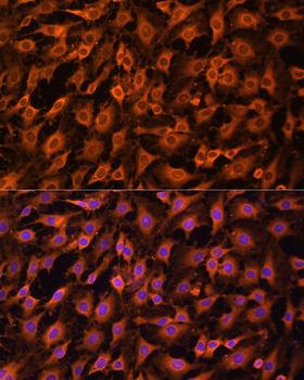 ERK1 + ERK2 Antibody - Immunofluorescence analysis of C6 cells using ERK1 / ERK2 Polyclonal Antibody at dilution of 1:100.Blue: DAPI for nuclear staining.