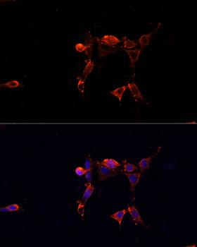 ERK1 + ERK2 Antibody - Immunofluorescence analysis of NIH/3T3 cells using ERK1 / ERK2 Polyclonal Antibody at dilution of 1:100.Blue: DAPI for nuclear staining.