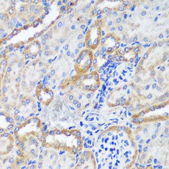 ERK1 + ERK2 Antibody - Immunohistochemistry of paraffin-embedded Mouse kidney using ERK1 / ERK2 Polyclonal Antibody at dilution of 1:200 (40x lens).