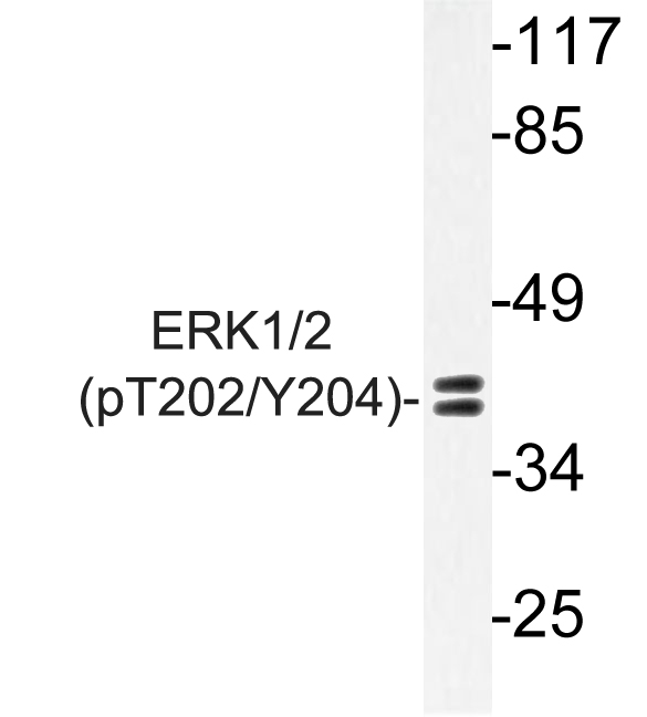 ERK1 + ERK2 Antibody - Western blot of p-ERK1/2 (T202/Y204) pAb in extracts from Jurkat PMA cells.