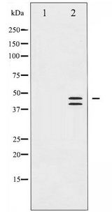 ERK1 + ERK2 Antibody - Western blot of p44/42 MAP Kinase phosphorylation expression in EGF treated A431 whole cell lysates,The lane on the left is treated with the antigen-specific peptide.