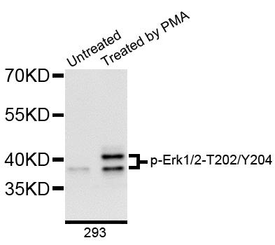 ERK1 + ERK2 Antibody - Western blot analysis of extracts of 293 cells.