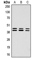 ERK1 + ERK2 Antibody - Western blot analysis of ERK1/2 (pT202/Y204) expression in A431 (A); Jurkat (B); HepG2 (C) whole cell lysates.