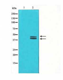 ERK1 + ERK2 Antibody - Western blot of ERK1/2 phosphorylation expression in HeLa whole cell lysates,The lane on the left is treated with the antigen-specific peptide.
