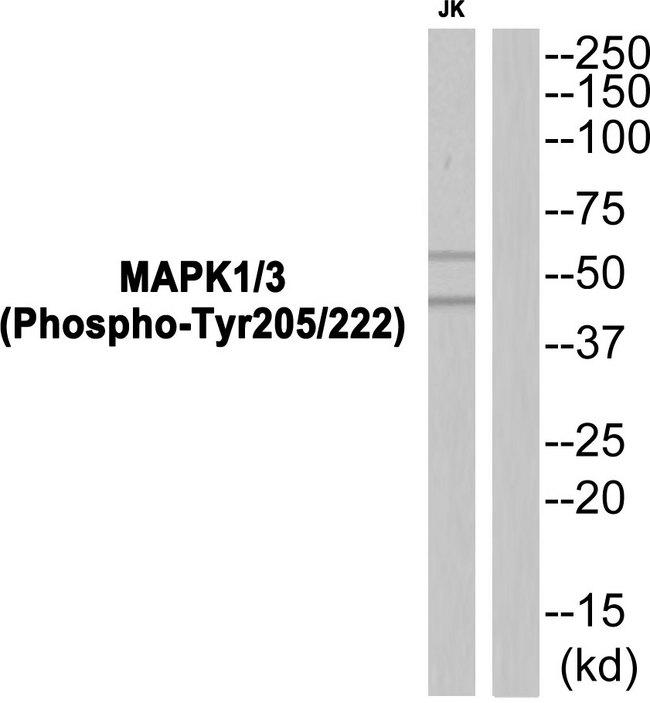 ERK1 + ERK2 Antibody - Western blot analysis of extracts from JK cells, using MAPK1/3 (Phospho-Tyr205/222) antibody.