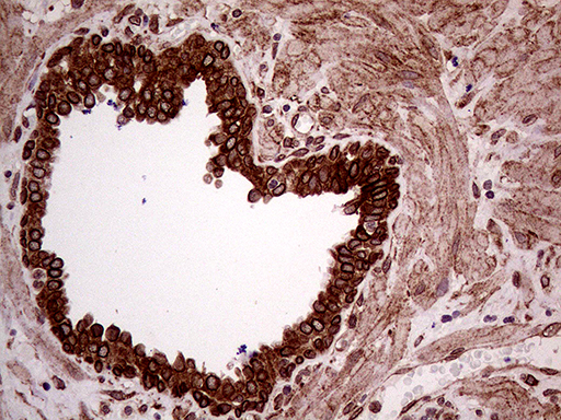 ERLIN1 / SPFH1 Antibody - Immunohistochemical staining of paraffin-embedded Human prostate tissue within the normal limits using anti-ERLIN1 mouse monoclonal antibody. (Heat-induced epitope retrieval by 1mM EDTA in 10mM Tris buffer. (pH8.5) at 120°C for 3 min. (1:2000)