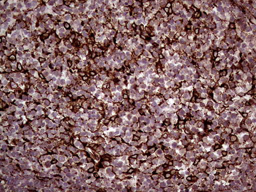 ERLIN1 / SPFH1 Antibody - Immunohistochemical staining of paraffin-embedded Human lymph node tissue within the normal limits using anti-ERLIN1 mouse monoclonal antibody. (Heat-induced epitope retrieval by 1mM EDTA in 10mM Tris buffer. (pH8.5) at 120°C for 3 min. (1:2000)