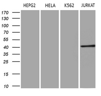 ERLIN1 / SPFH1 Antibody - Western blot analysis of extracts. (35ug) from 4 different cell lines by using anti-ERLIN1 monoclonal antibody. (1:500)