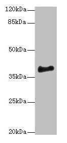 ERLIN1 / SPFH1 Antibody - Western blot All lanes: ERLIN1 antibody at 4µg/ml + Mouse brain tissue Secondary Goat polyclonal to rabbit IgG at 1/10000 dilution Predicted band size: 39 kDa Observed band size: 39 kDa