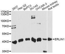 ERLIN1 / SPFH1 Antibody - Western blot analysis of extracts of various cell lines, using ERLIN1 antibody at 1:1000 dilution. The secondary antibody used was an HRP Goat Anti-Rabbit IgG (H+L) at 1:10000 dilution. Lysates were loaded 25ug per lane and 3% nonfat dry milk in TBST was used for blocking. An ECL Kit was used for detection and the exposure time was 90s.