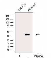 ERLIN1 / SPFH1 Antibody - Western blot analysis of extracts of COLO 320 cells using ERLIN1 antibody. The lane on the left was treated with blocking peptide.
