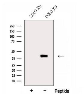 ERLIN1 / SPFH1 Antibody - Western blot analysis of extracts of COLO 320 cells using ERLIN1 antibody. The lane on the left was treated with blocking peptide.