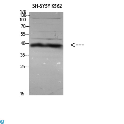 ERLIN1 / SPFH1 Antibody - Immunohistochemical analysis of paraffin-embedded human-liver, antibody was diluted at 1:200.