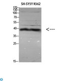 ERLIN1 / SPFH1 Antibody - Immunohistochemical analysis of paraffin-embedded human-liver, antibody was diluted at 1:200.