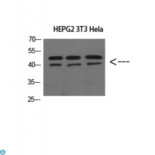 ERLIN1 / SPFH1 Antibody - Immunohistochemical analysis of paraffin-embedded human-liver, antibody was diluted at 1:200.