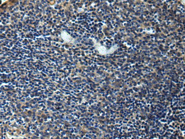 ERLIN1 / SPFH1 Antibody - Immunohistochemistry of paraffin-embedded Human tonsil tissue  using ERLIN1 Polyclonal Antibody at dilution of 1:50(×200)