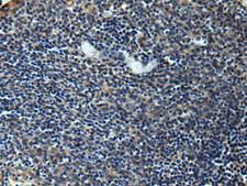 ERLIN1 / SPFH1 Antibody - Immunohistochemistry of paraffin-embedded Human tonsil tissue  using ERLIN1 Polyclonal Antibody at dilution of 1:50(×200)