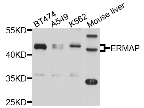 ERMAP / SC Antibody - Western blot analysis of extracts of various cell lines, using ERMAP antibody at 1:1000 dilution. The secondary antibody used was an HRP Goat Anti-Rabbit IgG (H+L) at 1:10000 dilution. Lysates were loaded 25ug per lane and 3% nonfat dry milk in TBST was used for blocking. An ECL Kit was used for detection and the exposure time was 15s.