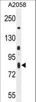 ERMARD Antibody - C6orf70 Antibody western blot of A2058 cell line lysates (35 ug/lane). The C6orf70 antibody detected the C6orf70 protein (arrow).